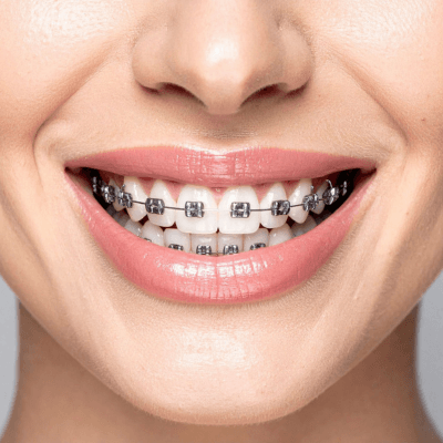Evercrest Dental