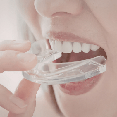 Sports Mouthguards By Evercrest Dental